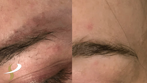 Explore anchor tattoo ideas, creative tattoo ideas in Spokane, available at Premier Body and Laser