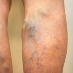 West Dermatology Rancho Santa Margarita image