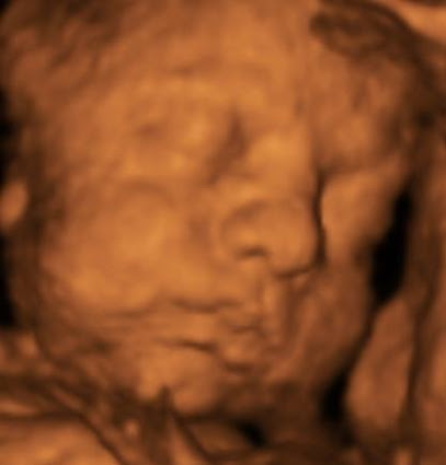 Blooming Baby Images - Mobile 3D Ultrasound