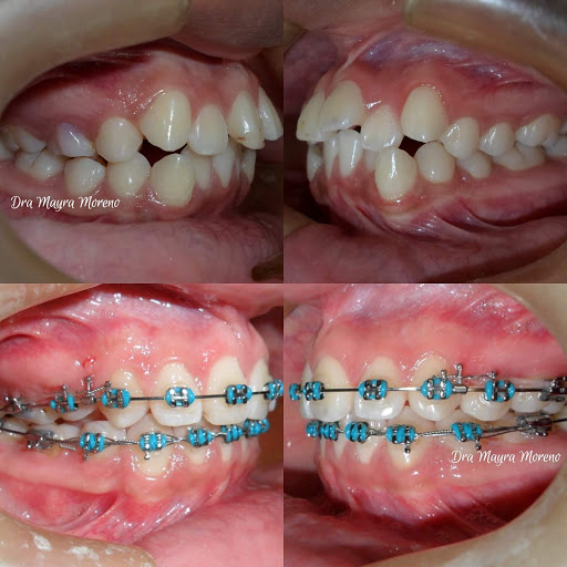Ortodoncia México - Dra. Mayra Moreno