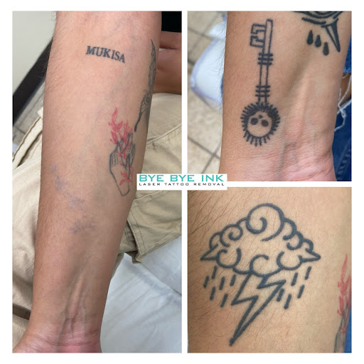 Explore wing tattoo ideas for guys, creative tattoo ideas in Middle Village, available at Bye Bye Ink Laser Tattoo Removal