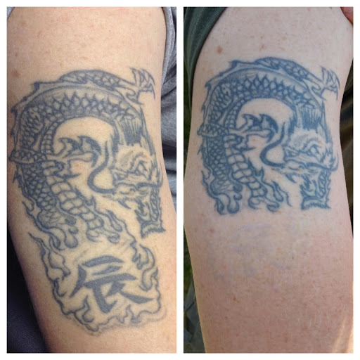 Explore new life tattoo ideas, creative tattoo ideas in Lawrence, available at Removery Tattoo Removal & Fading