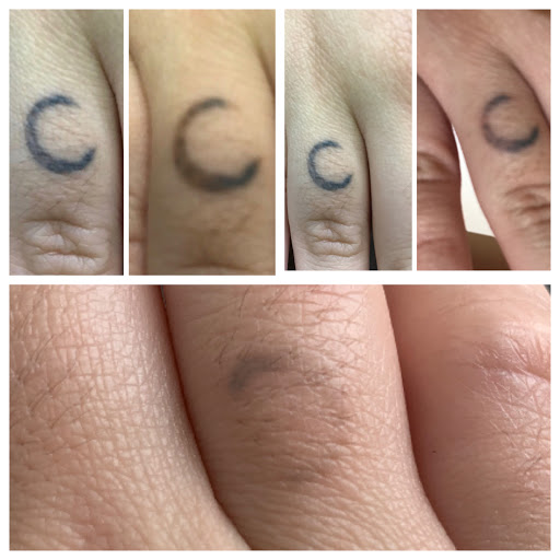 Explore female elbow tattoo ideas, creative tattoo ideas in Allen, available at Shipers Laser Tattoo Removal Center Dallas