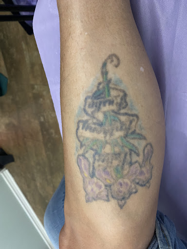 Explore shooting star tattoo ideas, creative tattoo ideas in Lake Jackson, available at Second Chance Laser Tattoo Removal