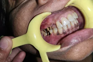 Dr Abhinav Dental and Implant Centre image