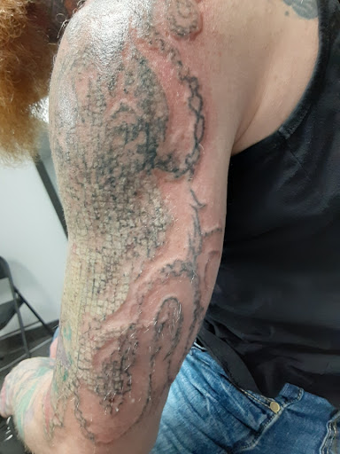 Explore tattoo ideas on breast, creative tattoo ideas in Saint Paul, available at Fearless Tattoo Removal