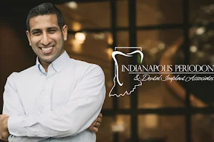 Indianapolis Periodontal & Dental Implant Associates image