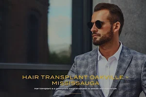 Nova Medical Hair Transplant Oakville | FUE • Hair Transplant image