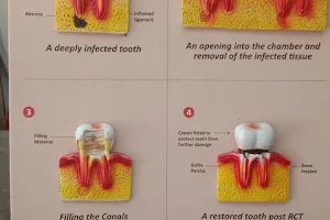 Dr. Thakur Dental Care Clinic image