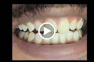 Eclipse Teeth Whitening image