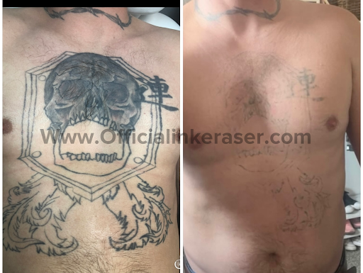 Explore against all odds tattoo ideas, creative tattoo ideas in Scottsdale, available at The INK Eraser