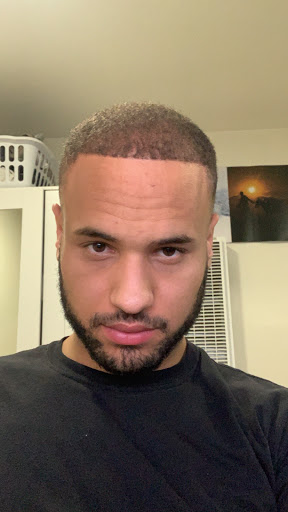 Hair Replacement Service «Medical Hair Transplant & Aesthetics», reviews and photos, 490 Post St #1701, San Francisco, CA 94102, USA