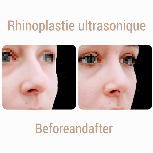 Dr. Franck Ouakil - Dr. Franck Ouakil