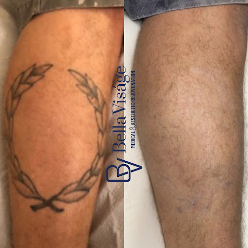 Explore ladybug tattoo ideas, creative tattoo ideas in Lakeland, available at Bella Visge Medical & Aesthetic Rejuvenation