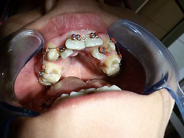 عيادة الأسنان دكتور حسنى عويس