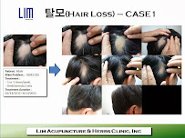 Lim Acupuncture & Herbs Clinic - Photo 7 - Car repair in Los Angeles, CA, Glendale