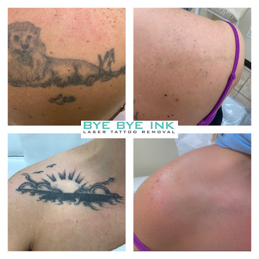 Explore thunderbird tattoo ideas, creative tattoo ideas in Middle Village, available at Bye Bye Ink Laser Tattoo Removal