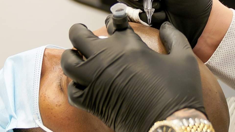 SCALPRO - Scalp Micropigmentation 80212