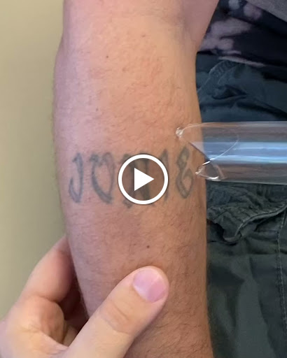 Explore candy tattoo ideas, creative tattoo ideas in Mentor, available at TakeTatt Tattoo Removal