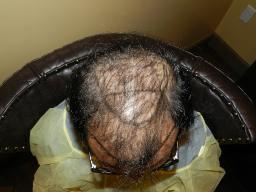 Medical Hair Transplant & Aesthetics image