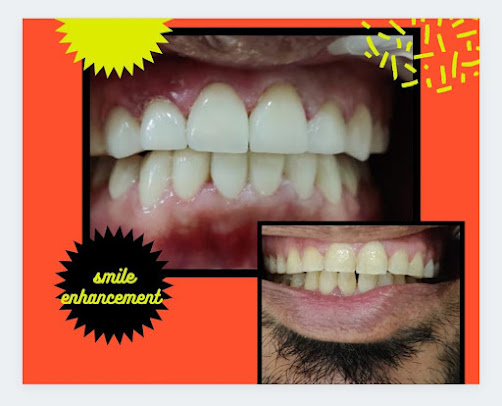 ابتسامة 4 الحياة عيادة الأسنان - Smile 4 Life Dental Clinic