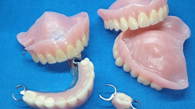 LABORATORIO I-DENTAL / Prótesis Dentales /Prótesis Acrílicas - Metálicas y Flexibles/ Planos de Relajación/ Reparaciones Dentales a domicilio/ Mecánico Dental