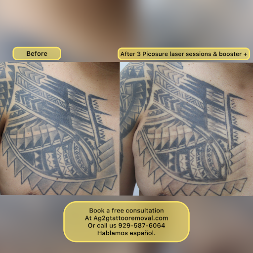 Explore tattoo ideas sleeve girl, creative tattoo ideas in New York, available at Ag2g Laser Tattoo Removal & MedSpa