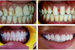 Krishna Dental & Cosmetic Clinic a specialized implant and orthodontic treatment center image