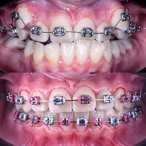 OrthoSmile. Ortodoncia y Odontología estética
