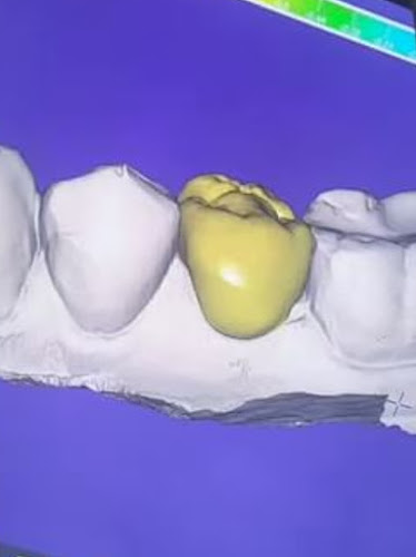 Clinica PlanDental - Valparaíso
