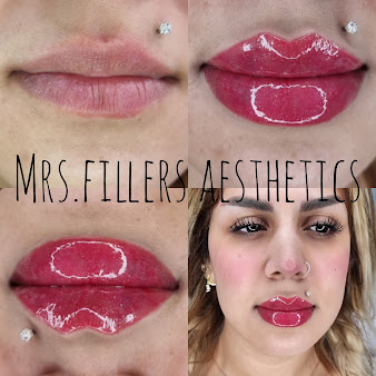 Mr. & Mrs. Fillers Aesthetics - Mr. & Mrs. Fillers Aesthetics