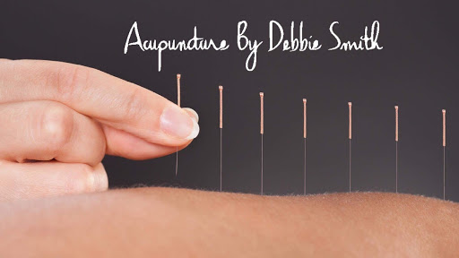 Debbie Smith Acupuncture