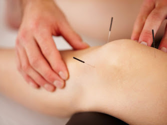 Massage Bizzness - Remedial Massage, Cupping, Dry Needling