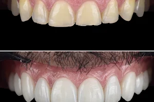 odontología odox Especialistas en diseños de sonrisa e implantes image