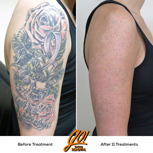 Explore bonnie and clyde tattoo ideas, creative tattoo ideas in Allentown, available at Removery Tattoo Removal & Fading