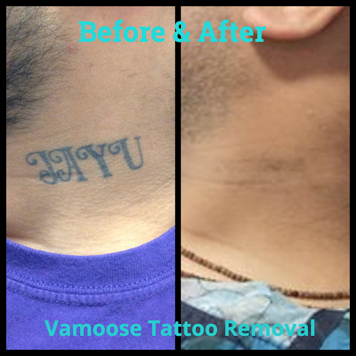 Explore tattoo ideas f, creative tattoo ideas in Milwaukee, available at Removery Tattoo Removal & Fading