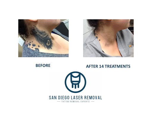 Explore small funny tattoo ideas, creative tattoo ideas in San Diego, available at Removery Tattoo Removal & Fading