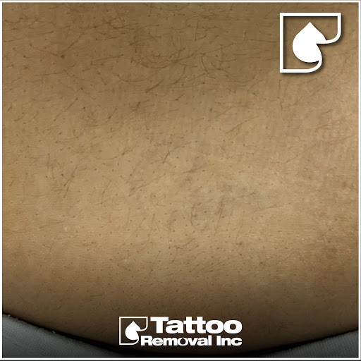 Explore tattoo ideas for son, creative tattoo ideas in South Gate, available at Tattoo Removal Inc