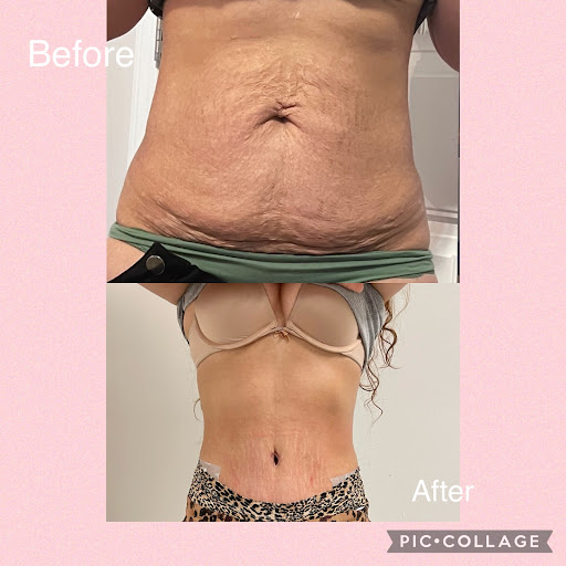 Explore thigh tattoo ideas, creative tattoo ideas in Savannah, available at Haute Brows. Cosmetic Tattoo