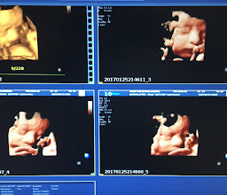 Ginecologo Queretaro. Dr. Abraham Gonzalez Consultorio en Star Médica photo