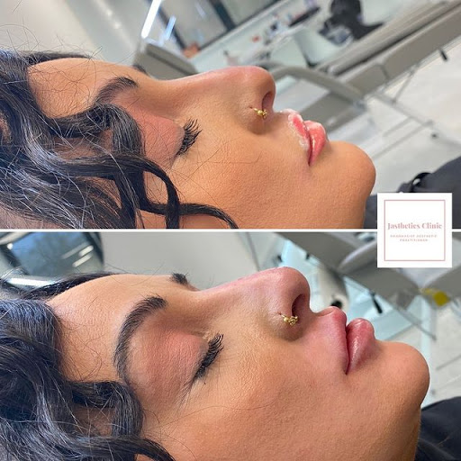 Jasthetics Clinic Skin Care Clinic