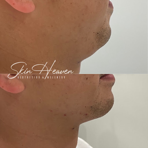 Skin Heaven Aesthetics and Wellness image