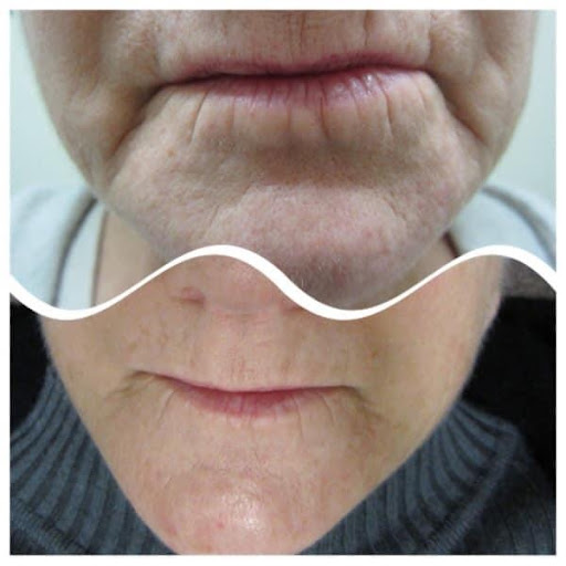 Explore skateboard tattoo ideas, creative tattoo ideas in Savannah, available at Haute Brows. Cosmetic Tattoo