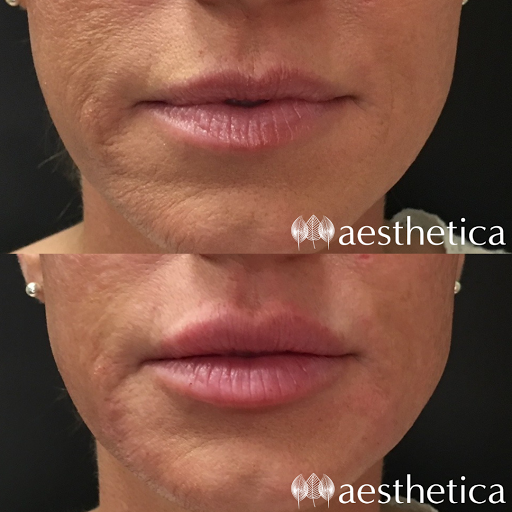 Explore rip neck tattoo ideas, creative tattoo ideas in Pleasant Grove, available at Aesthetica