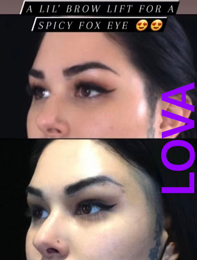 Explore cover up tattoos ideas forearm, creative tattoo ideas in Lake Oswego, available at Lake Oswego Vein and Aesthetic LOVA