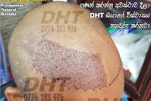 DHT Hair Transplant SriLanka image