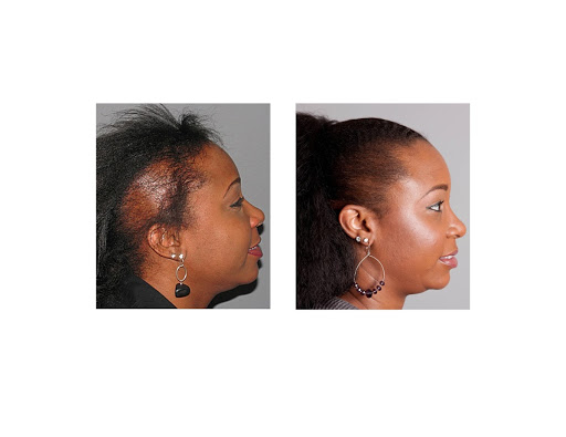 Hair Transplantation Clinic «Bosley Medical - Denver», reviews and photos, 6979 S Holly Cir #275, Centennial, CO 80112, USA