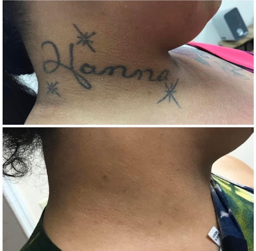 Explore mens leg tattoo ideas, creative tattoo ideas in Pinellas Park, available at St Pete Tattoo Removal