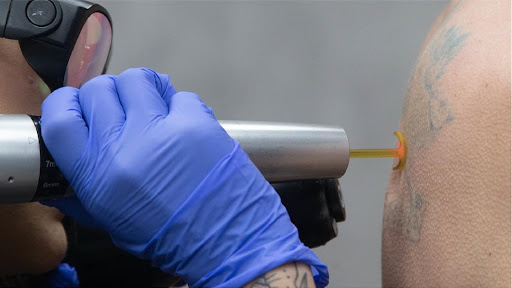 Explore no pain no gain tattoo ideas, creative tattoo ideas in Saint Paul, available at Removery Tattoo Removal & Fading