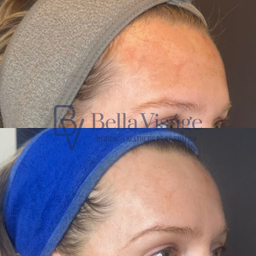 Explore psychedelic tattoo ideas, creative tattoo ideas in Lakeland, available at Bella Visge Medical & Aesthetic Rejuvenation